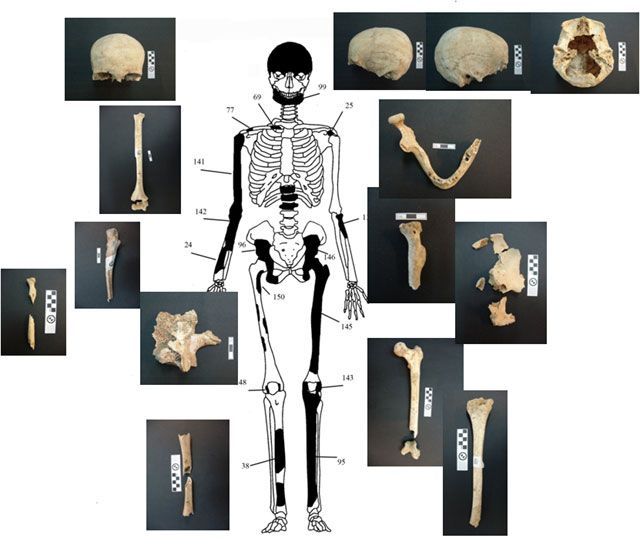 Ενδεικτική εκπροσώπηση οστών Ατόμου 1 με φωτογραφίες οστών.