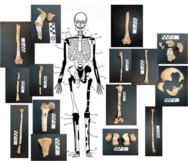 Ενδεικτική εκπροσώπηση οστών Ατόμου 2 με φωτογραφίες οστών.