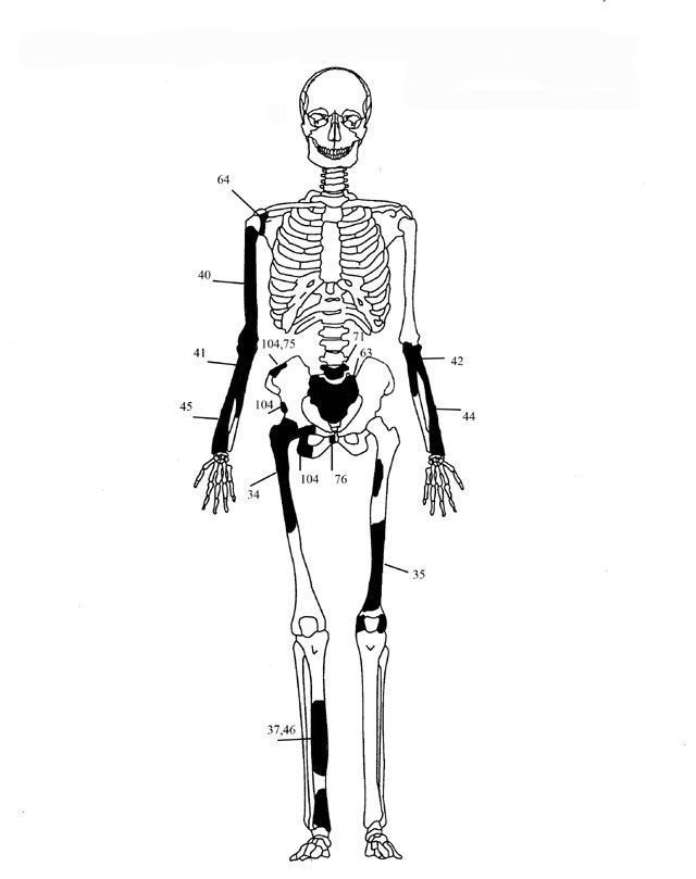 Ενδεικτική εκπροσώπηση οστών Ατόμου 3.