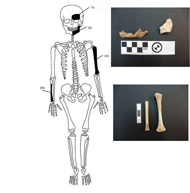 Ενδεικτική εκπροσώπηση οστών Ατόμου 4 με φωτογραφίες οστών.